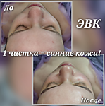 Аппаратные процедуры